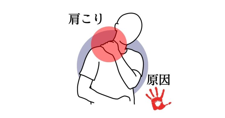 肩こりの原因(肩が張る・肩が凝る)は2つ疲れと身体の歪みやズレ | 久留米スポーツ整骨院 久留米市国分町