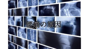 腰痛の原因を検査で特定できる？